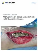Manual Of Soft-Tissue Management In Orthopaedic Trauma (1St Ed)