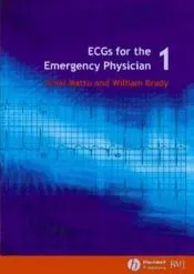 Ecgs for the Emergency Physician