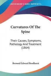 Curvatures of the Spine: Their Causes, S