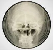 Bone Music: Soviet X-Ray Audio