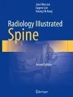 Radiology Illustrated: Spine
