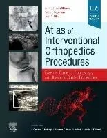 Atlas of Interventional Orthopedics Procedures: Essential Guide for Fluoroscopy and Ultrasound Guided Procedures