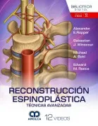 Reconstrucción Espinoplástica. Técnicas Avanzadas